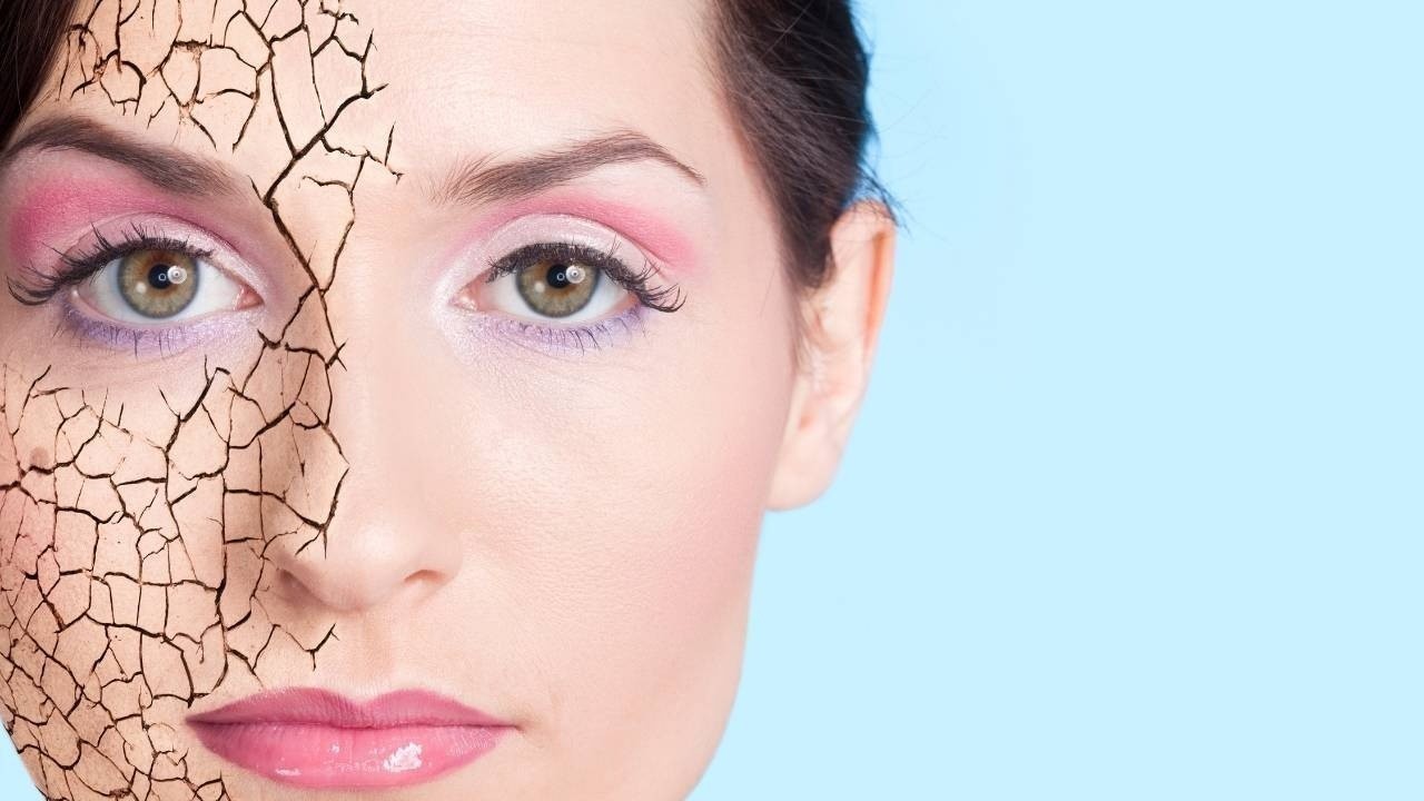 Winter Super Skincare: 5 Habits That Will Save Your Skin from Dryness