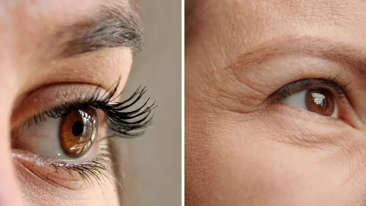 Top Eye Cream Ingredients to Reduce Dark Circles and Fine Lines